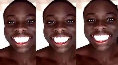 成人黑牙齿视频大全播放,视频大全带你了解口腔健康秘密