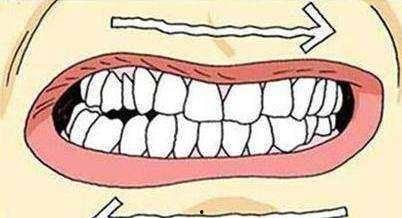 成人磨牙要打虫吗视频,成人磨牙需打虫？揭秘磨牙背后的真相
